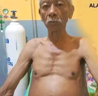 Bapak La Pigi Alami Tumor Perut, butuh Uluran Tangan Pemda dan Para Donatur
